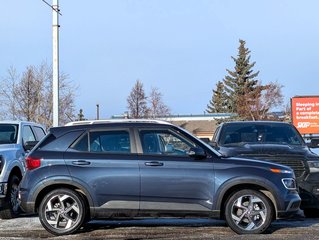 2023 Hyundai Venue Ultimate in Edmonton, Alberta - 3 - w320h240px