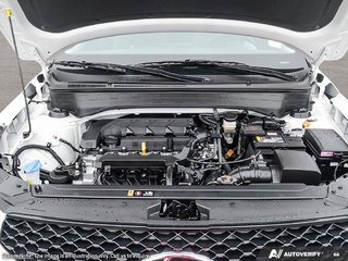 2026 Hyundai Venue Ultimate - Black interior in Edmonton, Alberta - 6 - w320h240px