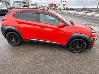 2018 Hyundai Kona Ultimate in Carleton, Quebec - 3 - w320h240cpx