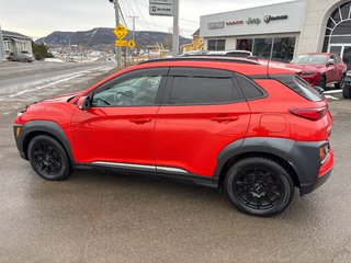 2018 Hyundai Kona Ultimate in Carleton, Quebec - 5 - w320h240cpx