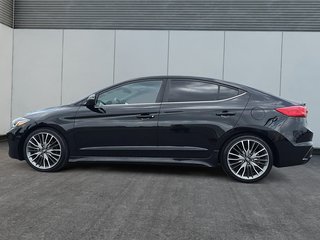 Hyundai Elantra Sport 2018 à St-Jean-Sur-Richelieu, Québec - 5 - w320h240cpx