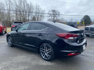 2020  Elantra SPORT in Sussex, New Brunswick - 3 - w320h240cpx