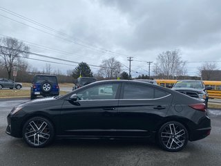 2020  Elantra SPORT in Sussex, New Brunswick - 2 - w320h240cpx