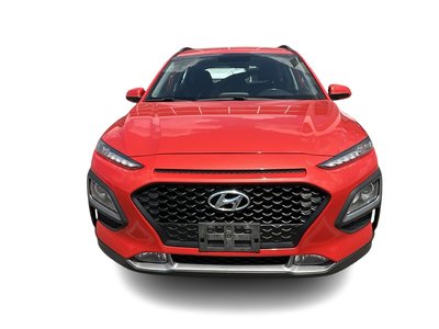 Hyundai Kona  2018 à Bolton, Ontario