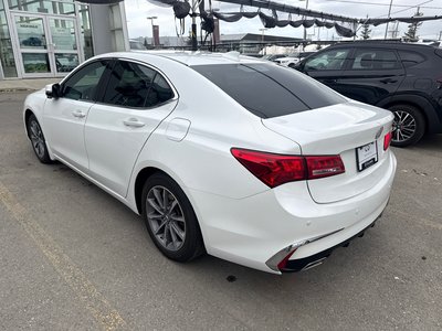 2018 Acura TLX in Calgary, Alberta