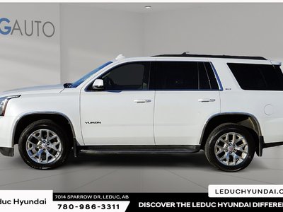 2017 GMC Yukon SLT — photo 5