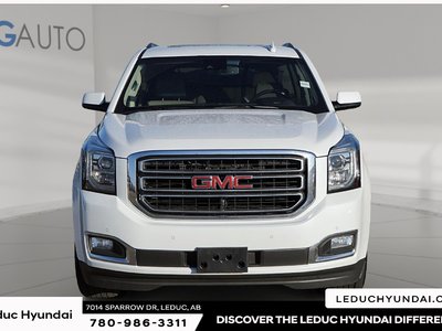 2017 GMC Yukon SLT — photo 2