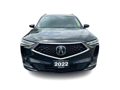 2022 Acura MDX in Markham, Ontario