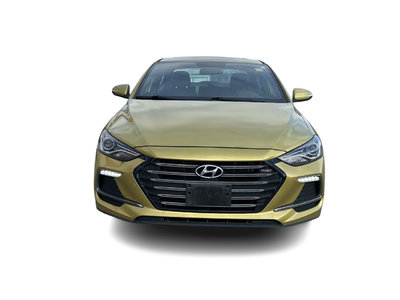 2017 Hyundai Elantra Sedan in Oakville, Ontario