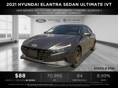 2021 Hyundai Elantra Sedan in Brampton, Ontario