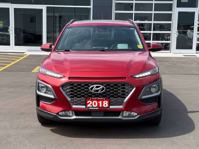 2018 Hyundai Kona 1.6T Ultimate-2