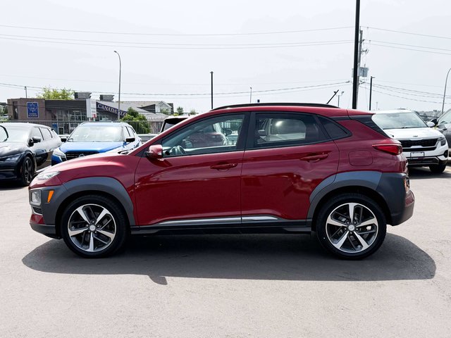 2018 Hyundai Kona 1.6T Ultimate-4