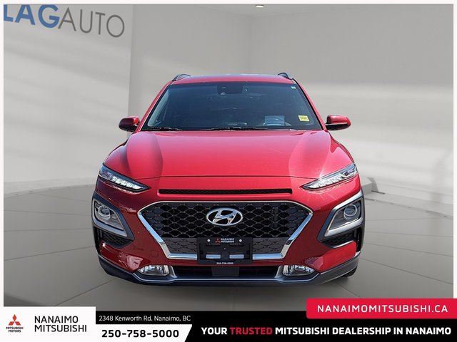 2021 Hyundai Kona 1.6T Ultimate-1