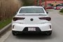 2025 Acura TLX A-Spec-3
