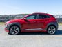 2020 Hyundai Kona 1.6T Trend-2
