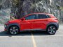 2020 Hyundai Kona 1.6T Ultimate-2