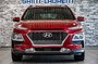 2020 Hyundai Kona ULTIMATE AWD TOIT OUVRANT NAVIGATION BLUELINK CUIR-7