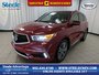 2018 Acura MDX Elite-0