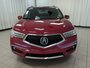 2018 Acura MDX Elite-2