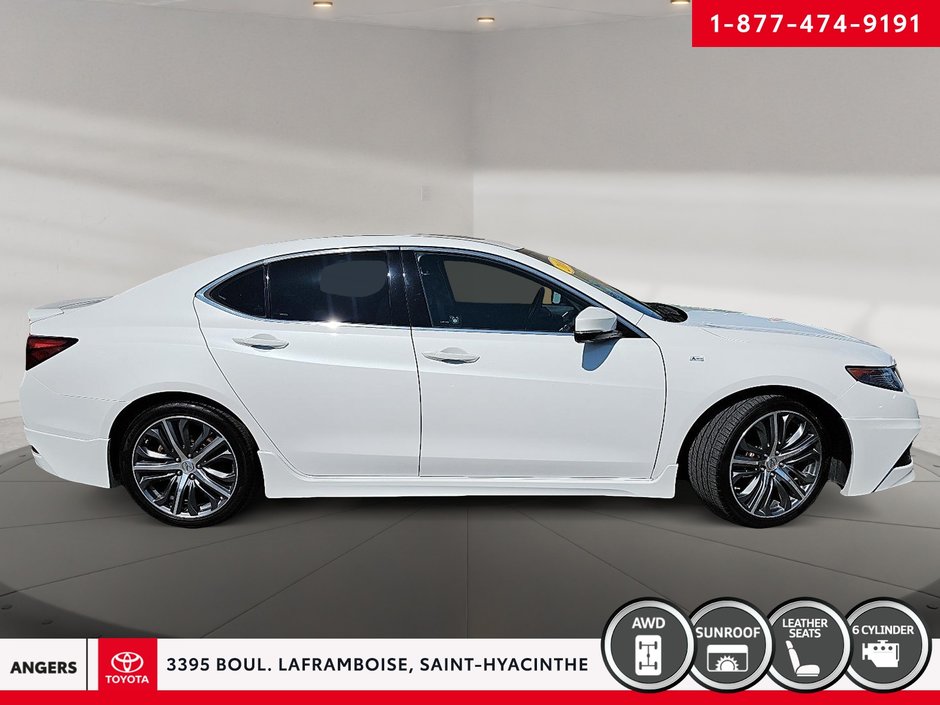 Acura TLX V6 Elite 2016-3