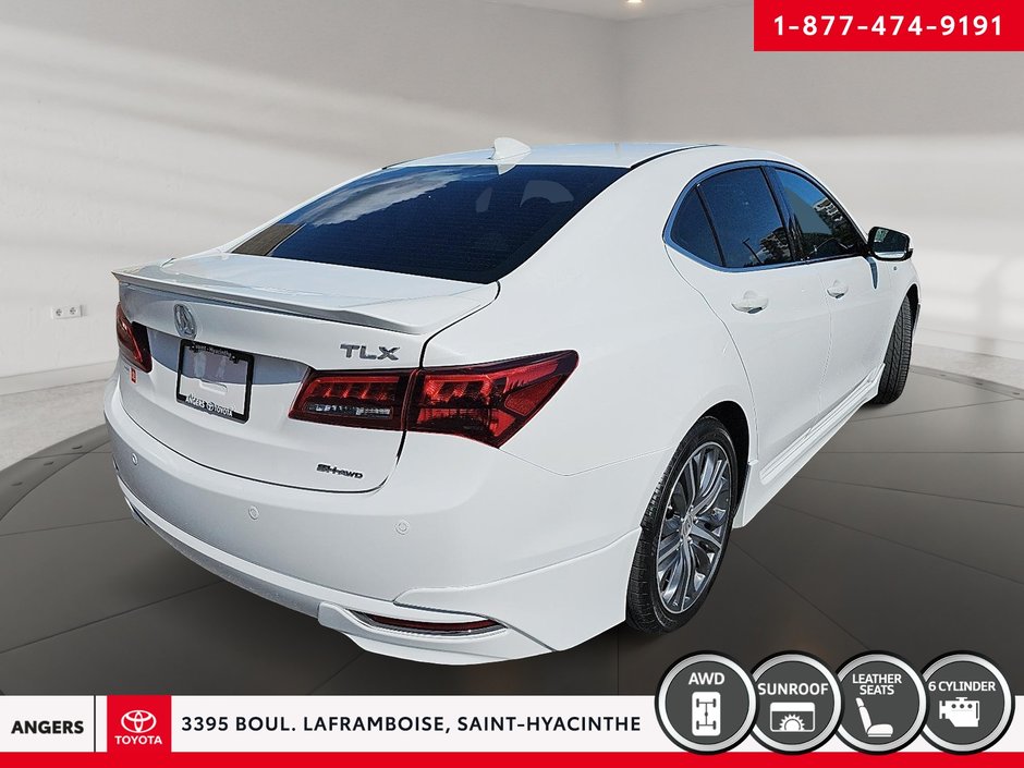 Acura TLX V6 Elite 2016-5