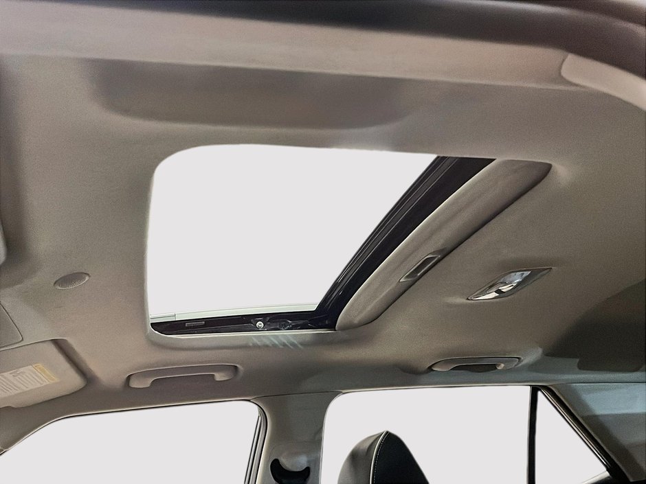 2020 Hyundai Venue Ultimate w/Black Interior-15