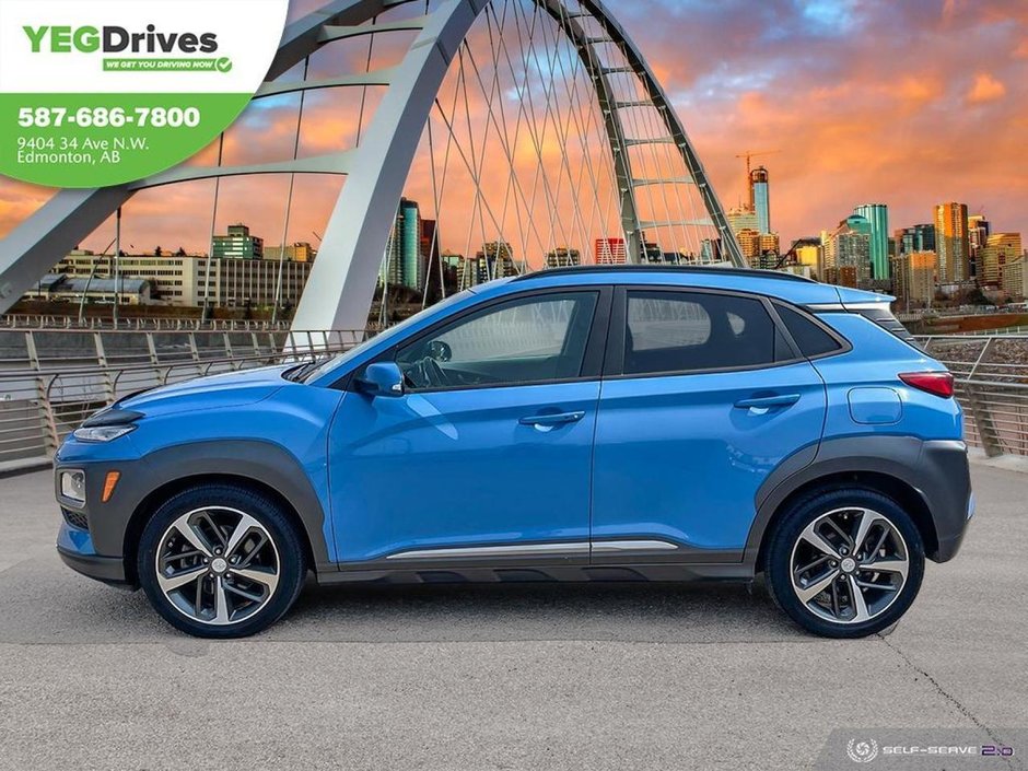 2018 Hyundai Kona Ultimate-2