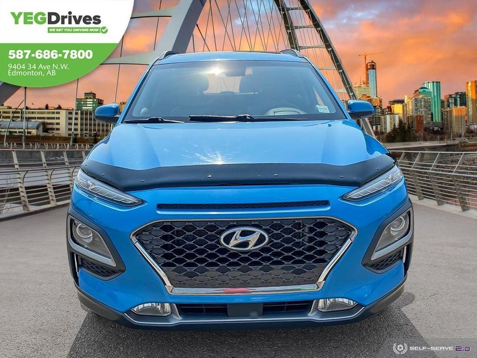 2018 Hyundai Kona Ultimate-1