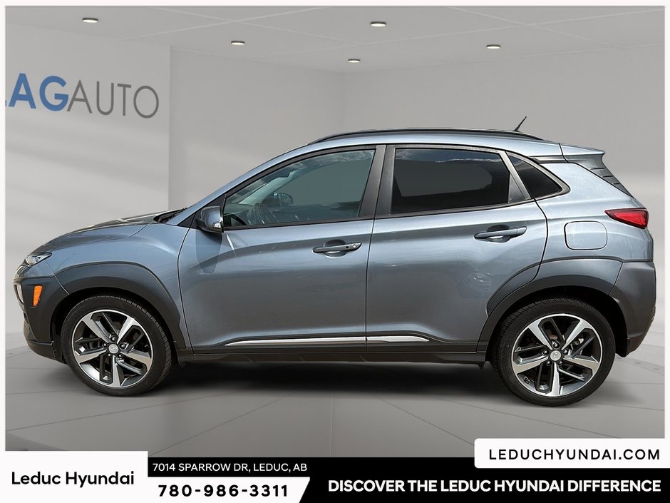 2018 Hyundai Kona 1.6T Ultimate-4
