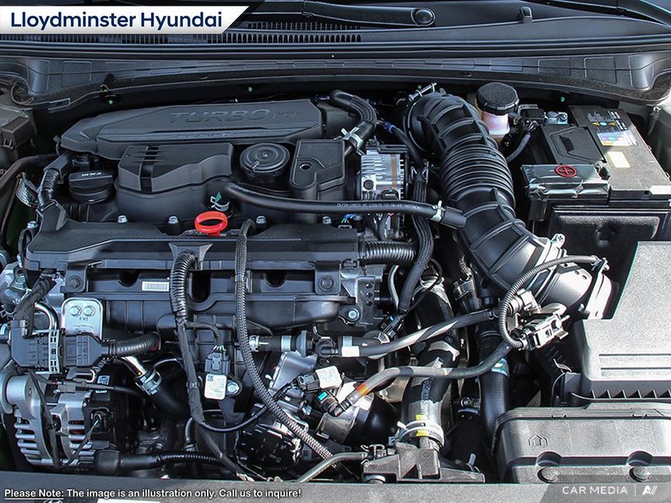 2025 Hyundai Elantra N Line Ultimate-5