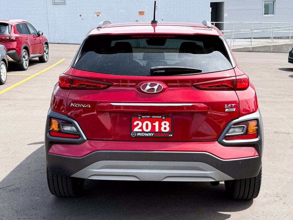 2018 Hyundai Kona 1.6T Ultimate-6