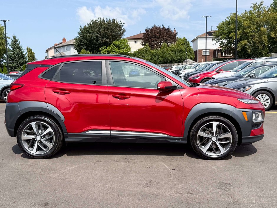 2018 Hyundai Kona 1.6T Ultimate-8