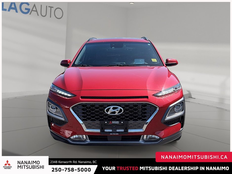 2021 Hyundai Kona 1.6T Ultimate-1