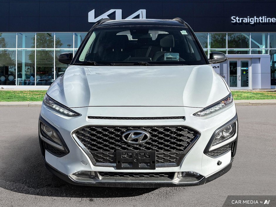 2018 Hyundai Kona TREND-1